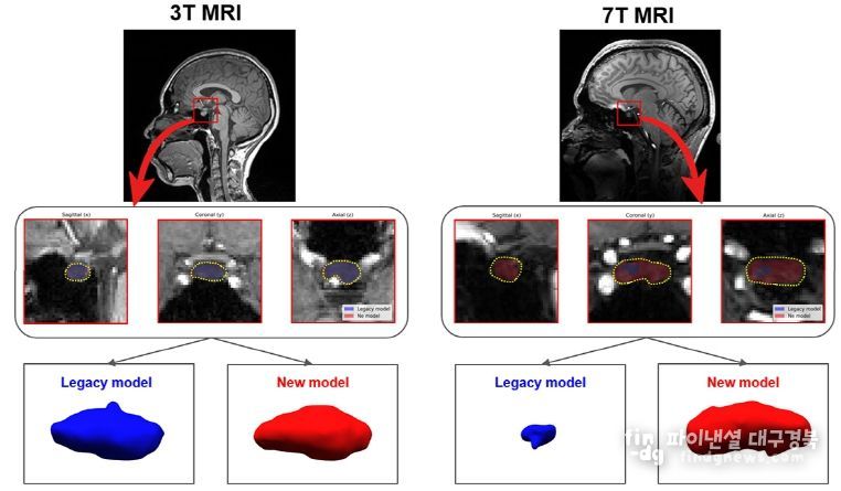 대한내분비학회서 ‘우수구연발표상’ 영예